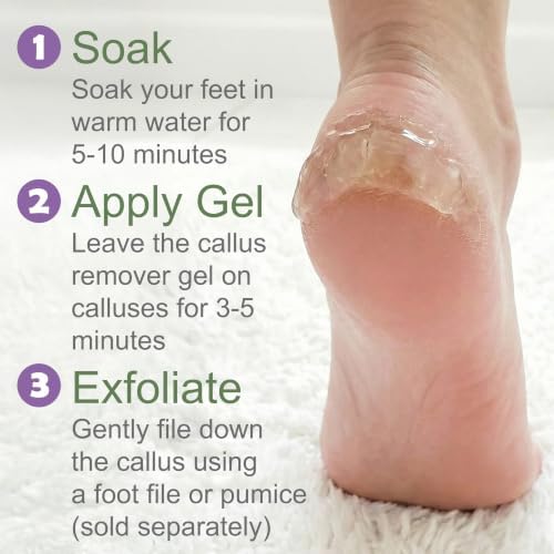 Callus Remover for Feet (Extra Strength 8 oz) Foot Callus Remover Gel