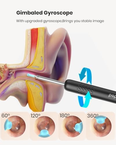 BEBIRD R1 Ear Wax Removal Tool:Ear Cleaner with HD Ear Camera FSA&HSA