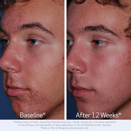 Obagi Medical CLENZIDERM M.D. Daily Care Foaming Cleanser