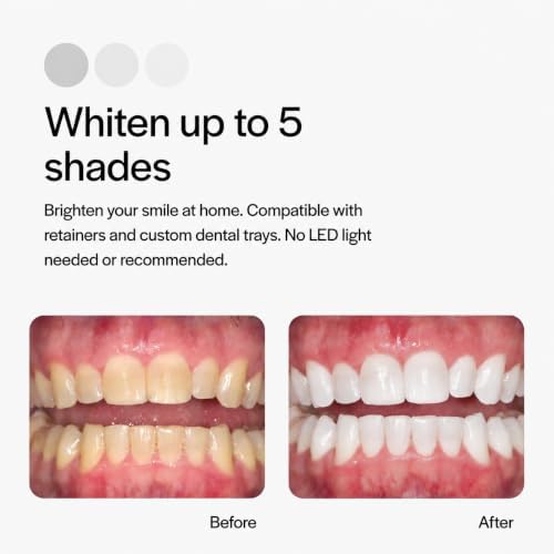 Opalescence 20% Carbamide Peroxide Teeth Whitening Gel Syringes - 5196-2
