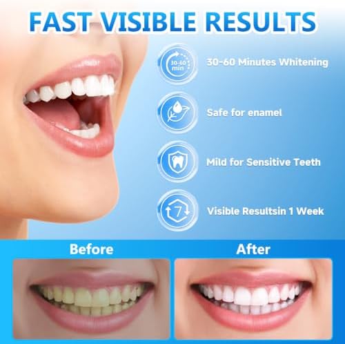 Milumber Teeth Whitening Strips for Sensitive, 42 Strips(21 Uses), Mint