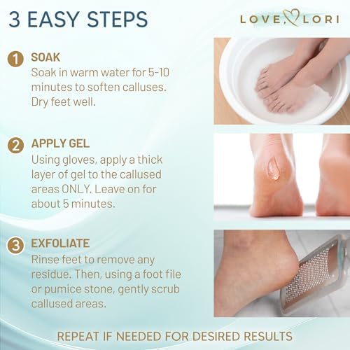 Love Lori Foot Callus Remover Gel Extra Strength Pedicure Tool for Feet 6oz