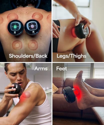 REVO The Original 4-in-1 Smart Cupping Massager with LED Light, Heat, Dynamic Suction & Vibration Massage, Portable Cordless Rechargeable Cupping Device for Body- 1 Pack