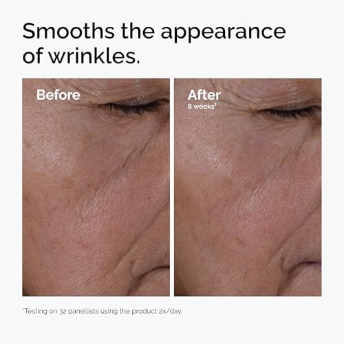 Multi-Peptide + Hyaluronic Acid, Anti-Aging Peptide Serum for Crow’s Feet, Elasticity & Firmness, 1 Fl Oz