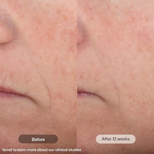 Revision Skincare Intellishade® Original SPF 45 Tinted Face Sunscreen
