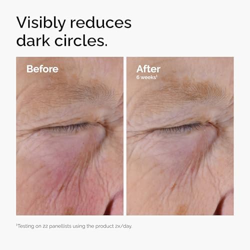 The Ordinary Caffeine Solution 5% + EGCG Eye Serum, Depuffing Eye Serum for Dark Circles and Tired Eyes
