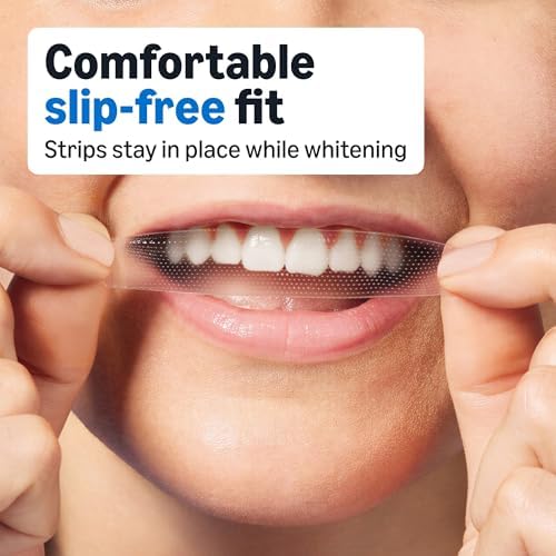 Amazon Basics 10 Day Teeth Whitening Strips Kit, 10 Treatments, 1-Pack, Packaging May Vary