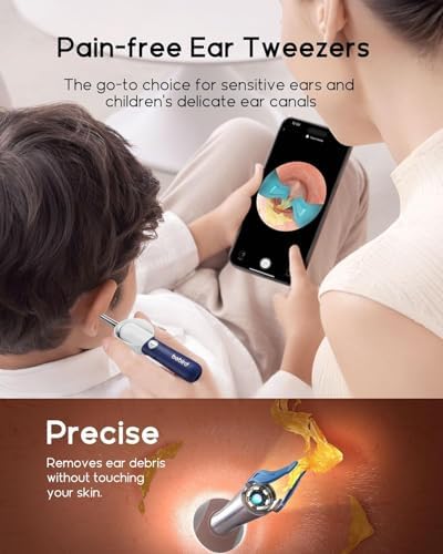 Bebird D39R Ear Wax Removal:Ear Camera with Storage Case &Painless Tweezers