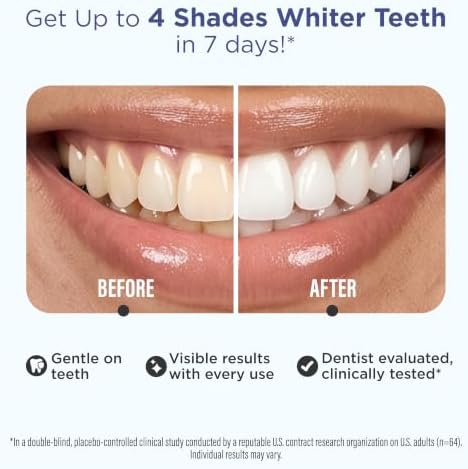 GuruNanda Teeth Whitening Strips - 4X Whiter Teeth, 7-Day Whitening Kit