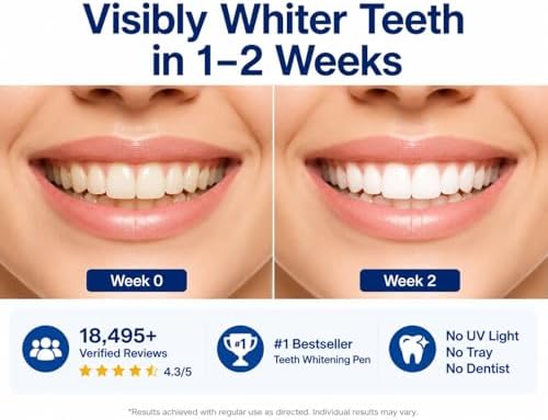 VieBeauti Teeth Whitening Pen Kit, 35% Carbamide Peroxide Gel, 5 Pack