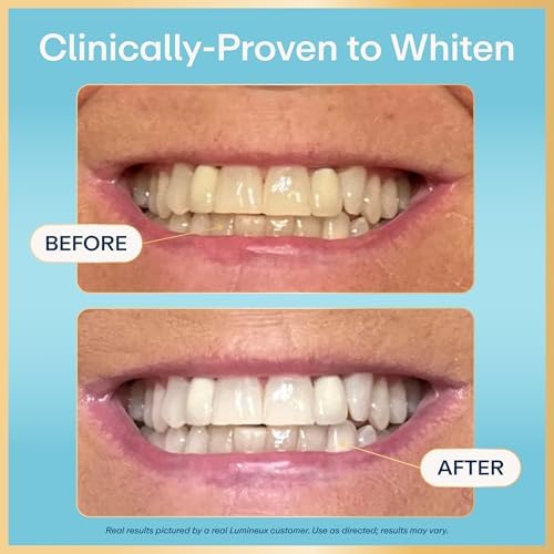 Lumineux 2-in-1 Teeth Whitening Pen, Removes Coffee & Tea Stains