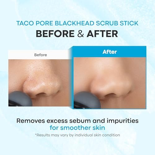 TONYMOLY Tako Pore Clay Scrub Stick, Korean Blackhead Exfoliator, 0.8 oz