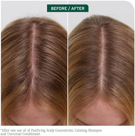 Biolage Scalp Sync Universal Conditioner – For All Scalp Types