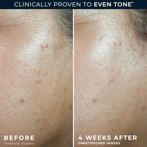 RoC Niacinamide Daily Face Moisturizer SPF 30, 5 in 1 Even Tone + Lift