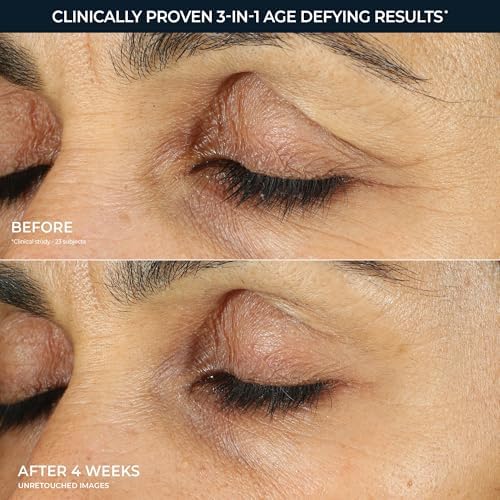 RoC Retinol Correxion Under Eye Cream for Dark Circles & Puffiness, 0.50z