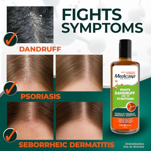 Medicasp Coal Tar Anti-Dandruff Shampoo, Flakes Shampoo, 6 fl oz