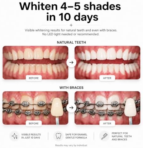 Opalescence Go 15% Mint - Prefilled Teeth Whitening Trays - 5194