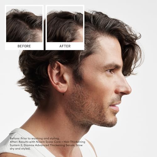 Nioxin System Kits | Scalp + Hair Thickening | 3 Month Supply