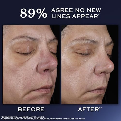 Lancôme Génifique Ultimate Recovery Serum - Hydrating Anti Aging Face Serum