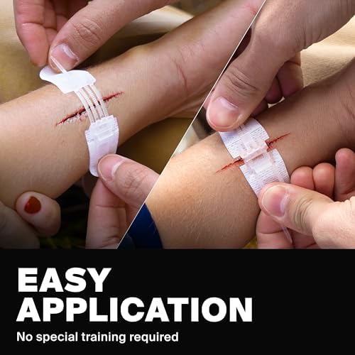SurviveX Zip Stitch Wound Closure Kit - No Stitches Needed