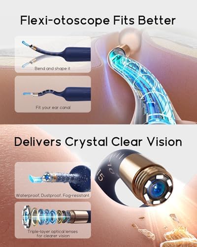 Bebird D39R Ear Wax Removal:Ear Camera with Storage Case &Painless Tweezers