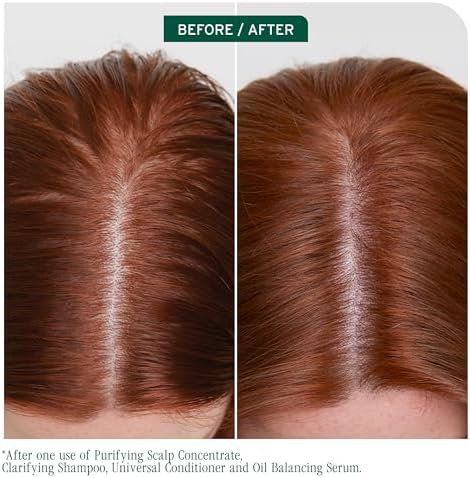 Biolage Scalp Sync Clarifying Shampoo – For Oily Scalp, 13.5 fl oz