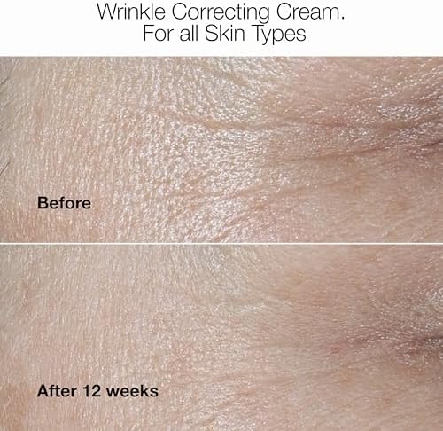 Clinique Smart Clinical Repair Face Cream Moisturizer | Now Available in Collagen + PDRN and Wrinkle Correcting Formulas