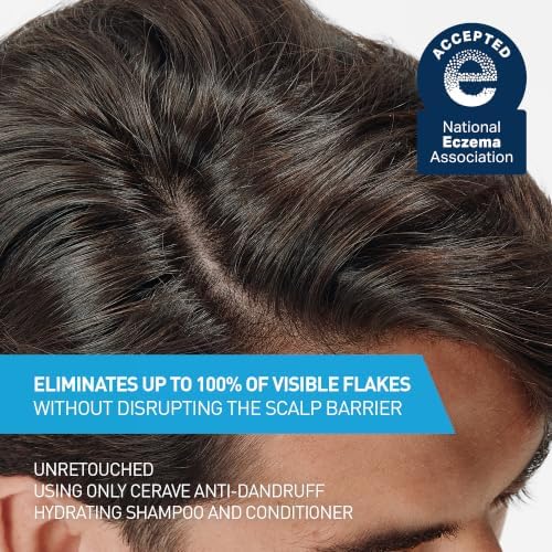 CeraVe Hydrating Anti Dandruff Shampoo, Itchy Scalp Treatment, 12oz