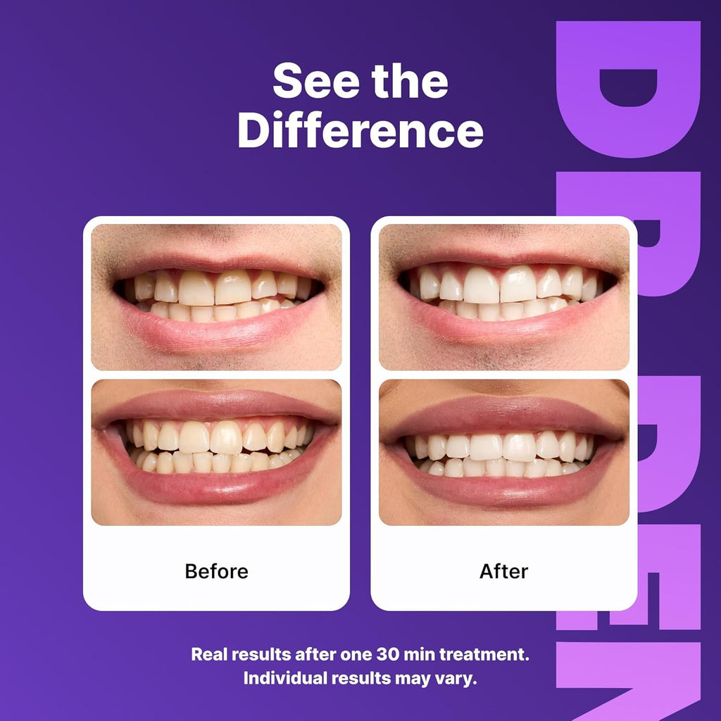 DRDENT Purple Teeth Whitening Strips - Safe for Enamel - Non Sensitive Teeth Whitening - Whitening Without Any Harm