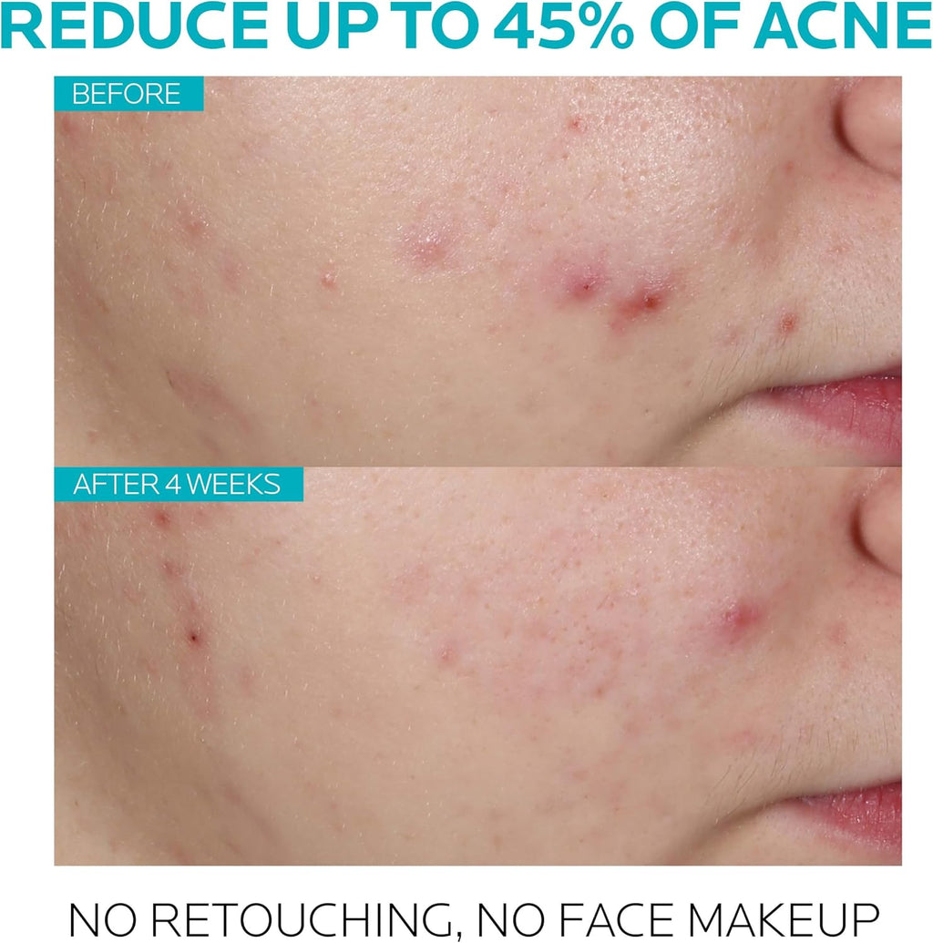 La Roche-Posay Effaclar Salicylic Acid Acne Serum Treatment Pore Minimizer